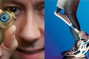 10 Teknologi pengganti organ manusia, bukti kemajuan dunia kesehatan