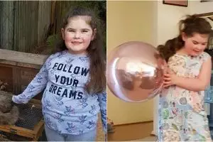 Kisah pilu bocah alami menopause di usia 7 tahun