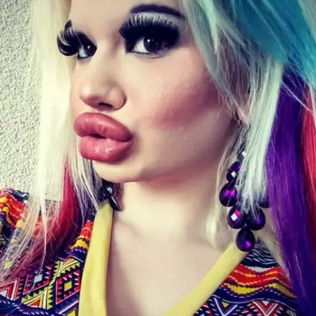 Wanita operasi 15 kali agar mirip Barbie, hasilnya bikin melongo