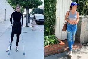 Tampak pakai kruk, ini cerita BCL saat berlibur di Amerika Serikat