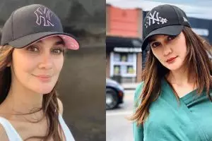 Terlihat flek hitam di wajah, foto Luna Maya justru tuai pujian