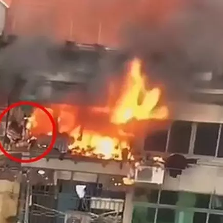 Kisah orangtua rela tubuhnya terbakar demi lindungi anak ini haru