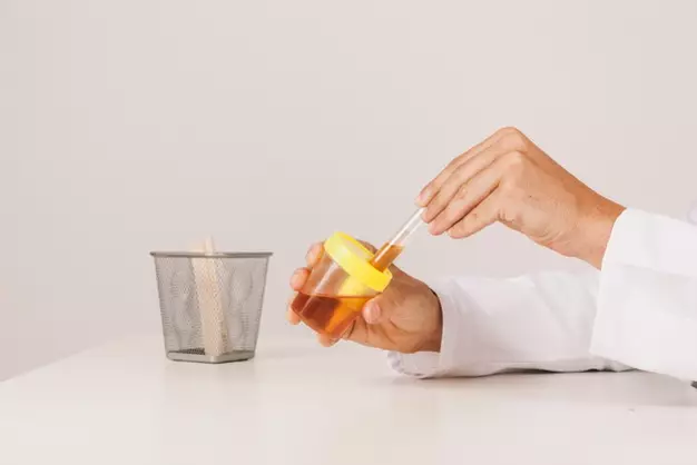 kanker prostat © mayoclinic.org dan sumber lainnya kanker prostat © mayoclinic.org dan sumber lainnya