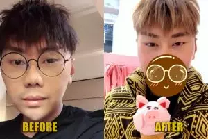 Sempat dibully, Roy Kiyoshi ungkap dirinya oplas hingga potong dagu