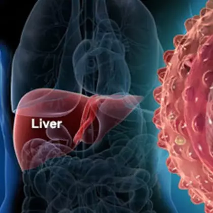 Sembuh dari hepatitis, ternyata pasien bisa terjangkit lagi