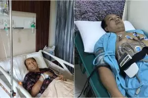 Kanker paru Sutopo sudah menyebar ke tulang dan organ lain