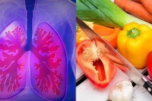 10 Makanan & minuman cegah kanker paru-paru, penyakit Sutopo Purwo