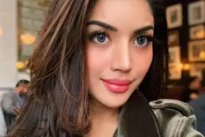 Millendaru blak-blakan soal transformasi tubuh, akui operasi 