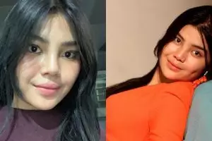 Meldianti ikut Age Challenge, potret perubahannya jadi sorotan