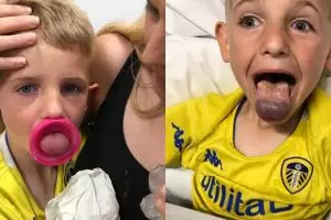 Bocah 6 tahun ini hampir kehilangan lidahnya karena lubang botol