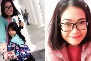 Kisah wanita yang disiram air keras oleh mantan suami, bikin haru