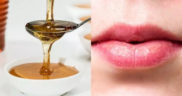 12 Cara alami atasi bibir kering dan pecah, ampuh & mudah dipakai