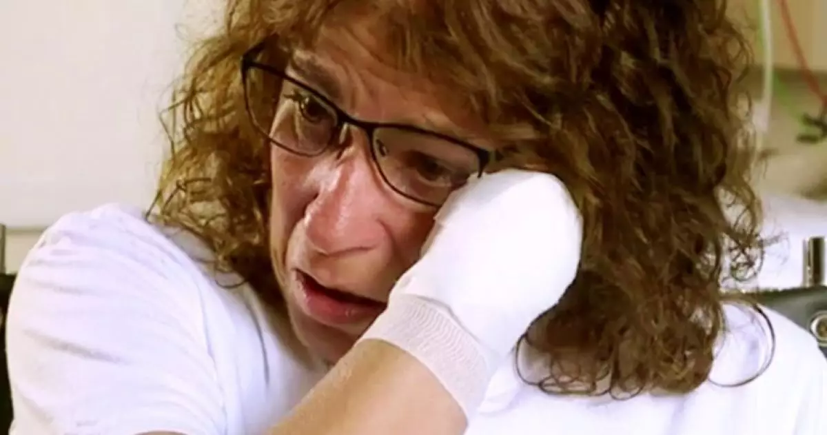 Bermula kena liur anjing, wanita ini kehilangan kaki & tangannya