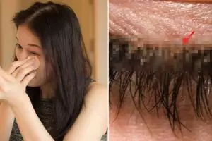 Wanita ini hampir terkena penyakit serius sebab malas bersihkan makeup