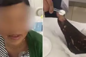 Tiru adegan film hisap bisa ular, wanita ini dilarikan ke RS