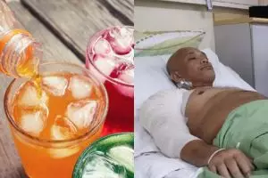 Minum soft drink setiap hari, lengan pria ini alami pembusukan