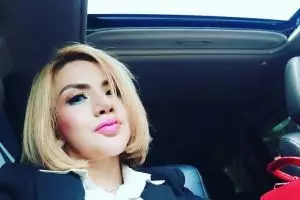 Beda penampilan 3 seleb sebelum dan sesudah sulam lesung pipi