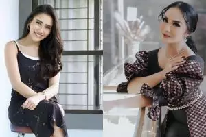 Demi cantik, 5 seleb ini dikabarkan pernah lakukan suntik putih