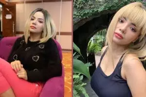 Demi bersihkan jerawat, Dinar Candy rela habiskan uang puluhan juta