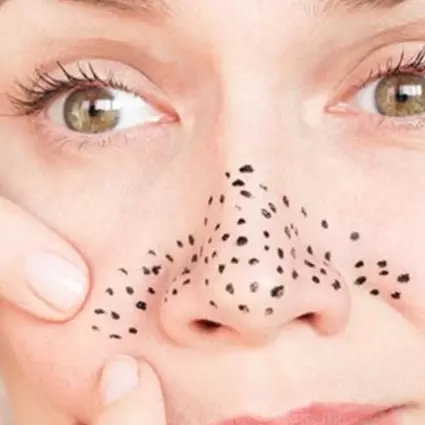 7 Cara menghilangkan komedo dengan buah-buahan, alami dan ampuh