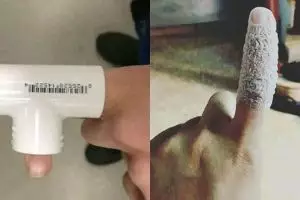 7 Penampakan tangan dan kaki tak biasa ini bikin ngilu