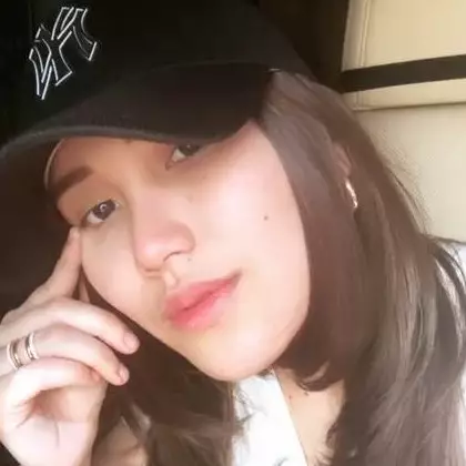 Unggah foto liburan sama Bilqis, bibir Ayu Ting Ting jadi sorotan