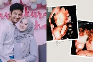7 Momen kenangan manis Irish Bella & Ammar dengan bayi kembarnya