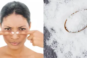 7 Cara menghilangkan komedo dengan garam, praktis dan ampuh