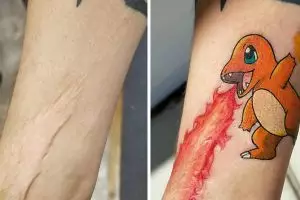 8 Bentuk bekas luka di kulit ini bikin melongo