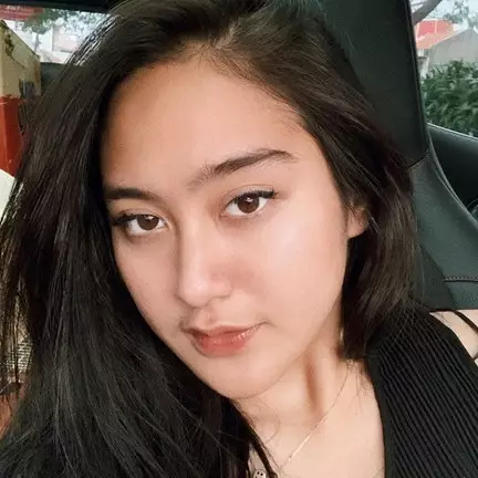 Kisah ngeri Salshabilla Adriani, nyaris buta karena softlens