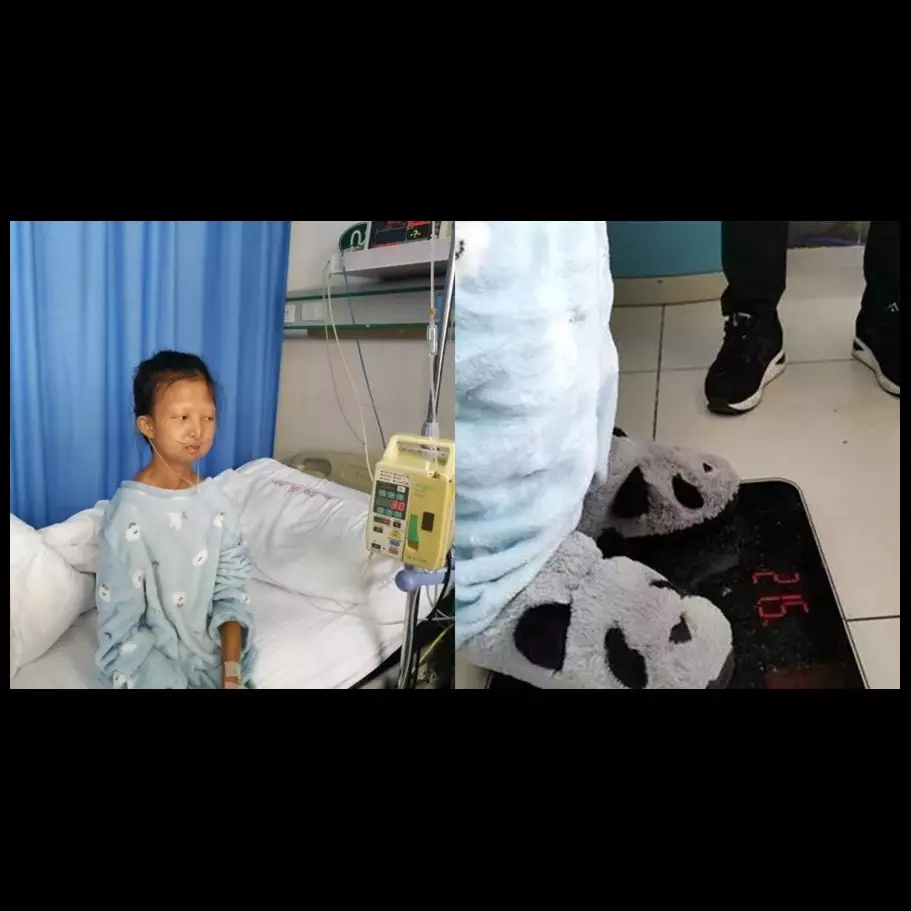 Kisah haru gadis 24 tahun alami kekurangan gizi ekstrem