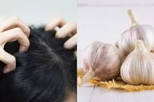 11 Cara menghilangkan kutu rambut dengan bahan alami