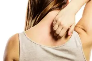 8 Cara menghilangkan panu dengan bahan alami, cepat & mudah