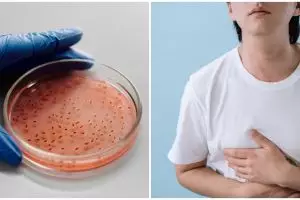 13 Penyebab diare berdarah, gejala, dan cara mengatasinya