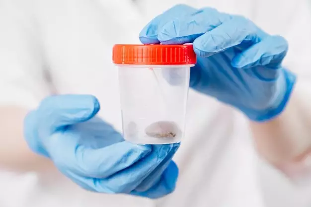 15 Penyebab usus buntu © 2021 brilio.net 15 Penyebab usus buntu © 2021 brilio.net