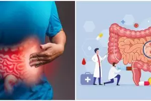 17 Penyebab usus buntu, beserta gejala dan cara mengobatinya