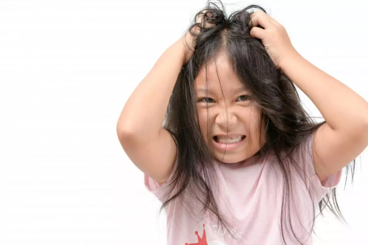 10 Penyebab rambut rontok pada anak dan cara mengatasinya