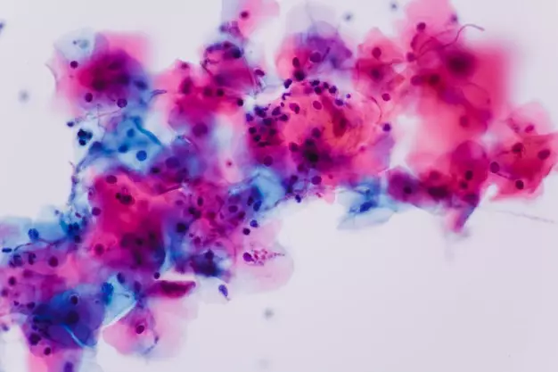 keputihan pada remaja © berbagai sumber keputihan pada remaja © berbagai sumber