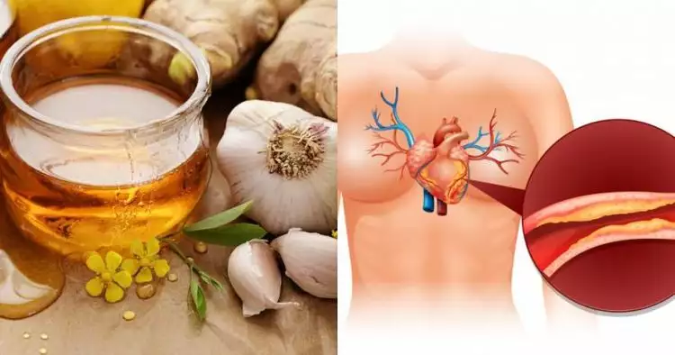 8 Manfaat bawang putih dan madu untuk tubuh & cara pakainya
