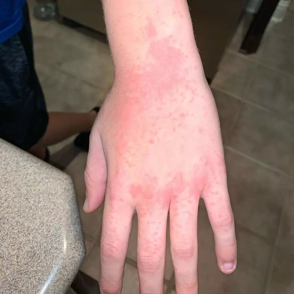  11 Jenis penyakit kulit dan cara alami mengatasinya freepik.com