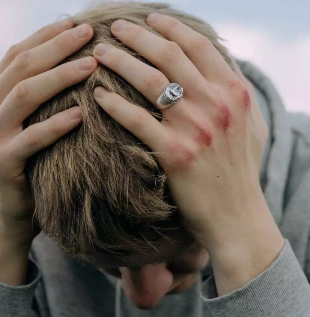 Penyebab rambut rontok © 2021 brilio.net