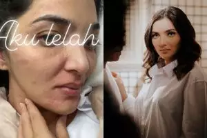 Dokter masih belum tahu pemicu penyakit Ashanty