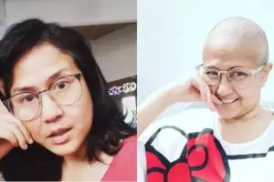 Empat hari jalani perawatan intensif, kondisi Ria Irawan membaik