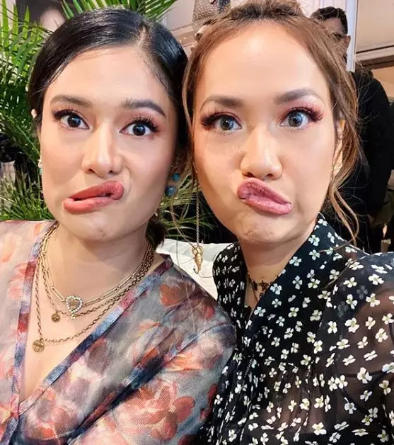 pose bibir BCL dan Dian jadi sorotan  Instagram