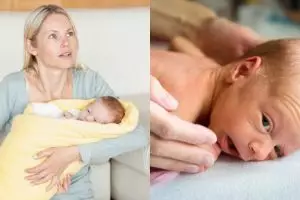 Kenali penyebab penyakit kuning pada bayi dan cara mengatasi