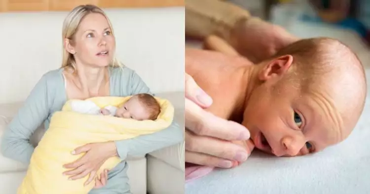 Kenali penyebab penyakit kuning pada bayi dan cara mengatasi