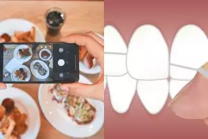 6 Penyebab sariawan di gusi dan cara mudah mencegahnya