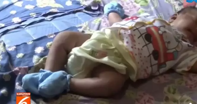 bayi digerogoti tikus © liputan6.com