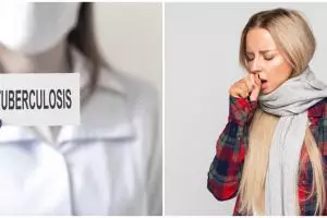 6 Cara mengobati TBC, lengkap dengan gejala dan penyebabnya