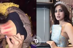 6 Seleb cantik ini tak segan pamer kerokan, terbaru Jess Amalia